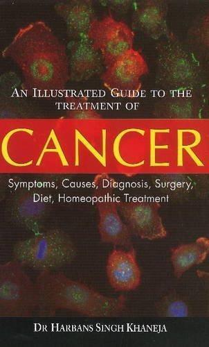 An Illustrated Guide to the Treatment of Cancer: Symptoms, Causes, Diagnosis,
