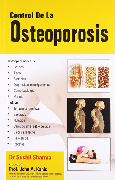 Control de la osteoporosis [Paperback]