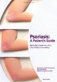 Psoriasis By N.J. Lowe, PB ISBN13: 9781853175992 ISBN10: 1853175994 for USD 36.08