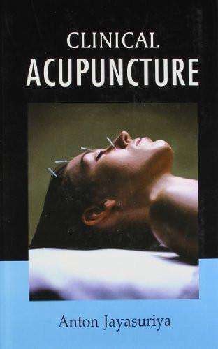 Clinical Acupuncture: Free Acupuncture Charts Along With the Book [Hardcover]