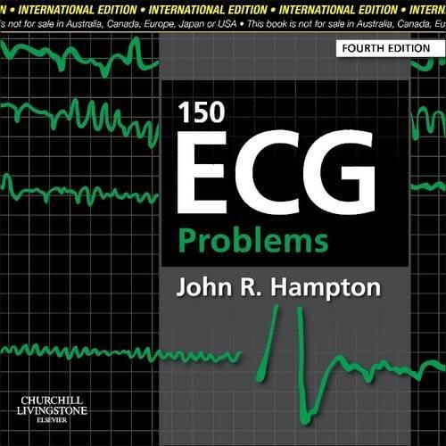 150 ECG Problems [Sep 25, 2013] Hampton, John R.] [[Condition:Brand New]] [[Format:Paperback]] [[Author:Hampton, John R.]] [[ISBN:070204671X]] [[Edition:4th International edition]] [[ISBN-10:070204671X]] [[binding:Paperback]] [[manufacturer:Churchill Livingstone]] [[number_of_pages:320]] [[package_quantity:17]] [[publication_date:2013-09-25]] [[brand:Churchill Livingstone]] [[ean:9780702046711]] for USD 39.09