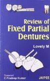 Review of Fixed Partial Dentures by Lovely M Paper Back ISBN13: 9788180617812 ISBN10: 8180617815 for USD 27.59