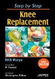 Step by Step Knee Replacement (with DVD-ROM) by SKS Marya Paper Back