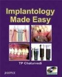 Implantology Made Easy with DVD-ROM by TP Chaturvedi Paper Back