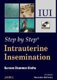 Step by Step Intrauterine Insemination (with DVD-ROM) by Surveen Ghumman Sindhu Paper Back
