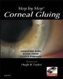 Step By Step Corneal Gluing with DVD-ROM by Rasik B Vajpayee Paper Back