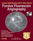 Jaypee Gold Standard Mini Atlas Series Fundus Flourescein Angiography (with Photo CD-Rom) by Ashok Garg Paper Back ISBN13: 9789350250051 ISBN10: 9350250055 for USD 30.9