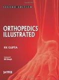 Orthopedics Illustrated by RK Gupta Paper Back ISBN13: 9789350251096 ISBN10: 9350251094 for USD 31.46