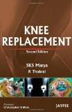 Knee Replacement  (With Interactive DVD-Rom) by SKS Marya  R Thukral Paper Back