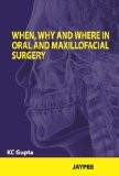 When  Why And Where In Oral And Maxillofacial Surgery by KC Gupta Paper Back ISBN13: 9789350253564 ISBN10: 9350253569 for USD 20.47