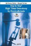 Step by Step High Tibial Osteotomy by Hemicallotasis by Ajit Kumar Mehta Paper Back ISBN13: 9789350256466 ISBN10: 9350256460 for USD 21.17