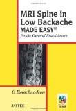 MRI Spine in Low Backache Made Easy: for the General Practitioner by G Balachandran Paper Back ISBN13: 9789350257142 ISBN10: 9350257149 for USD 25.89