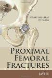 Proximal Femoral Fractures by DD Tanna  Sudhir Babhulkar Paper Back ISBN13: 9789350903711 ISBN10: 9350903717 for USD 39.23