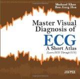 Master Visual Diagnosis of ECG: A Short Atlas (Learn ECG Through ECG) by Shahzad Khan  Ren Jiang Hua Paper Back ISBN13: 9789350904893 ISBN10: 9350904896 for USD 36.74