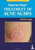 Step by Step Treatment of Acne Scars by Niti Khunger Paper Back ISBN13: 9789350909577 ISBN10: 935090957X for USD 39.38