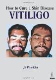 How to Cure a Skin Disease Vitiligo by JS Pasricha Paper Back ISBN13: 9789351521198 ISBN10: 9351521192 for USD 18.74