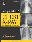 Interpretation of Chest X-ray: An Illustrated Companion by G Balachandran Paper Back ISBN13: 9789351521723 ISBN10: 9351521729 for USD 23.7