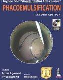 Jaypee Gold Standard Mini Atlas Series: Phacoemulsification (with DVD) by Amar Agarwal  Priya Narang Paper Back