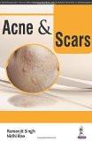 Acne & Scars by Ramanjit Singh  Nidhi Rao Paper Back ISBN13: 9789351529699 ISBN10: 935152969X for USD 27.56