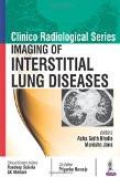 Clinico Radiological Series: Imaging of Interstitial Lung Diseases by Ashu Seith Bhalla Manisha Jana Co-Editor: Priyanka Naranje Clinical Content Editors: Randeep Guleria GC Khilnani Paper Back ISBN13: 9789386322517 ISBN10: 938632251X for USD 46.41